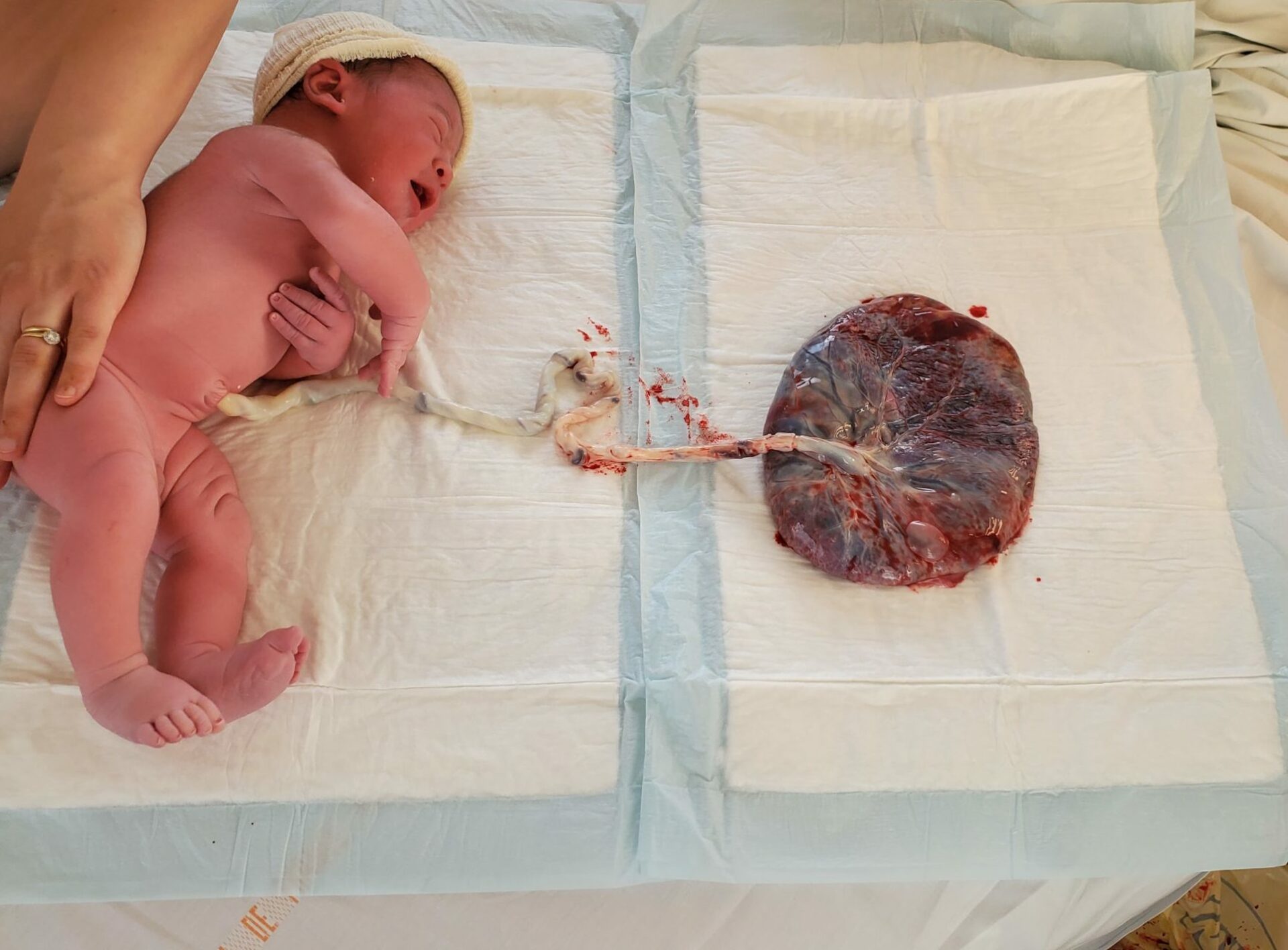 bébé avec son placenta